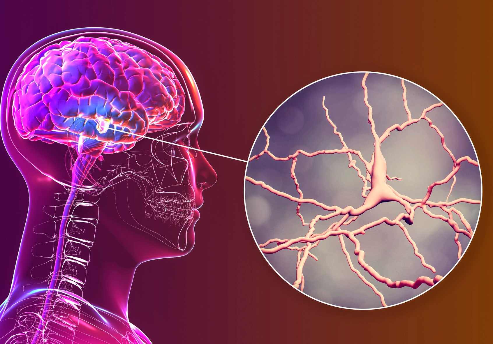 Πώς να διαγνώσετε και να θεραπεύσετε τον εγκέφαλο προβάτου, πρόληψη ασθενειών