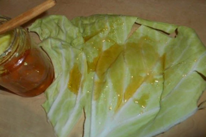 Honey enhances the therapeutic effect of the cabbage leaf