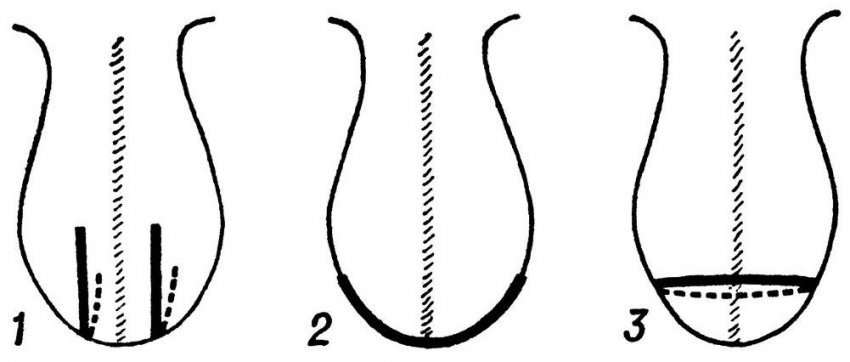 Incision of the scrotum during castration