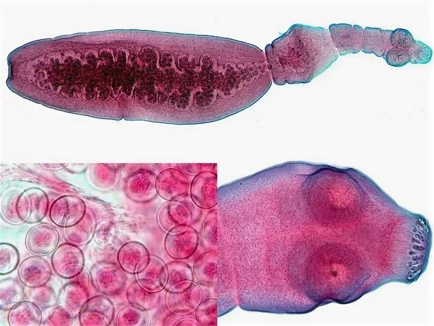 Echinococcus worm