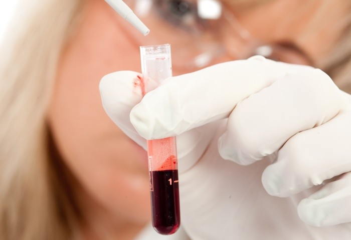 Krevní test