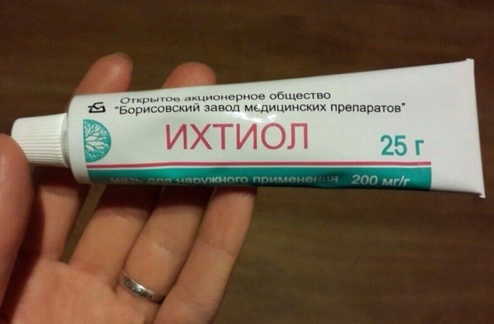 Ichthyol ointment
