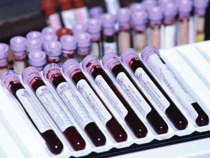 Piglet blood test